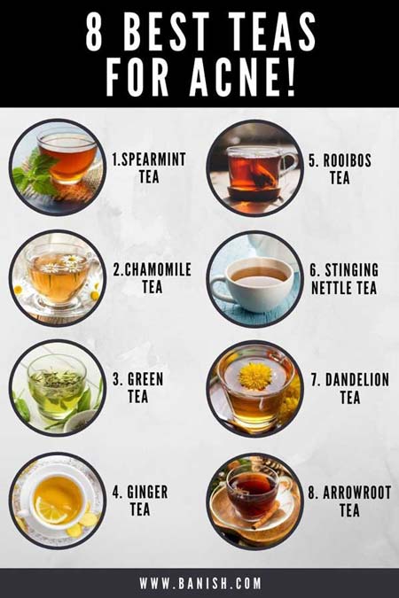 best teas for acne