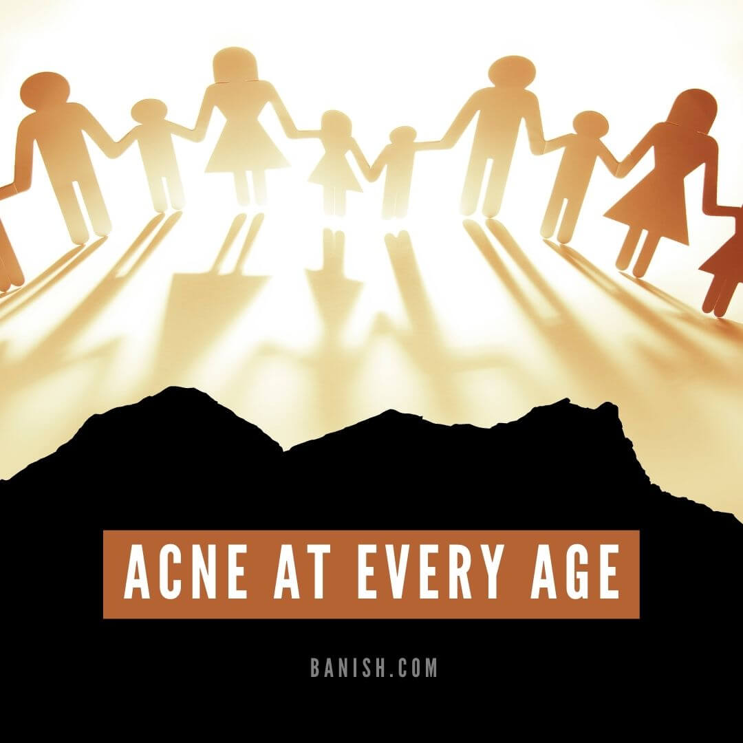 frustrating acne