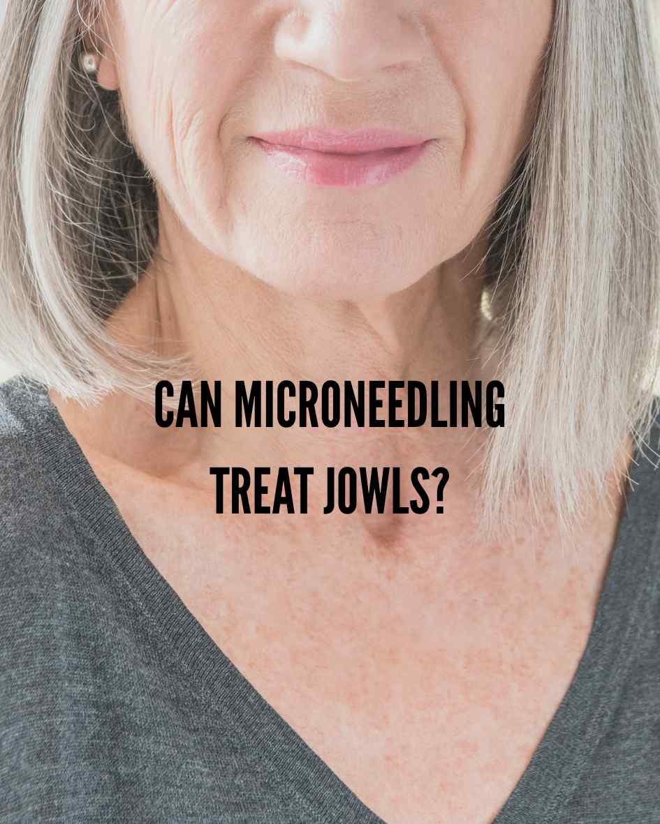 image of woman smiling with slight jowls