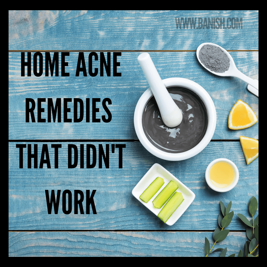 Home Remedies That Didn't Work