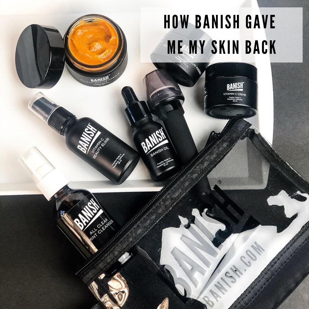 banish acne scars