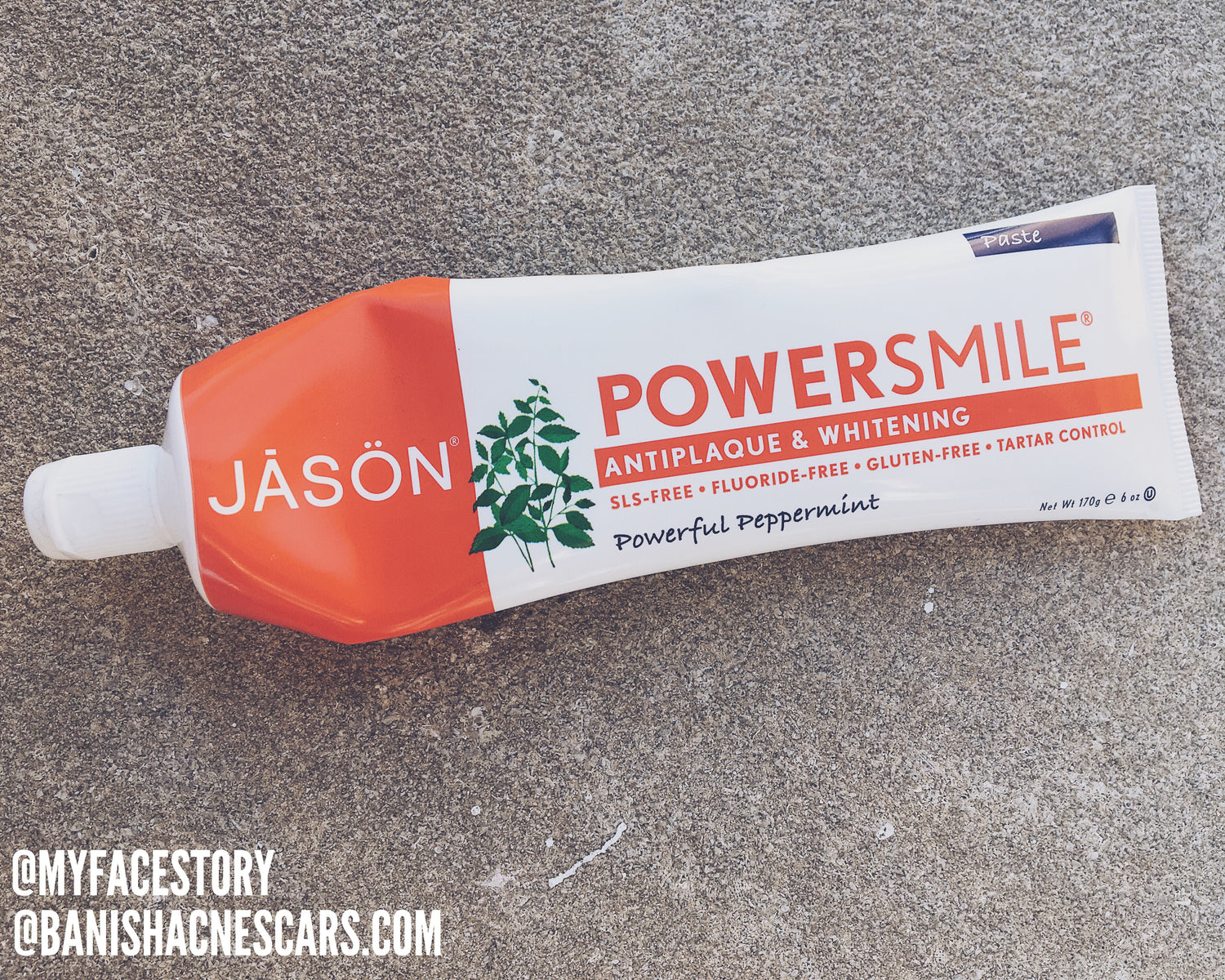 toothpaste making you breakout