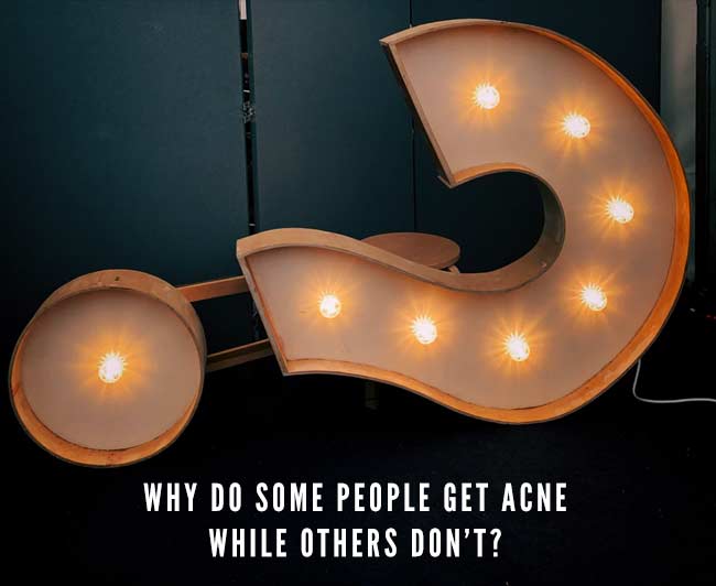 acne questions why do I get acne when others dont