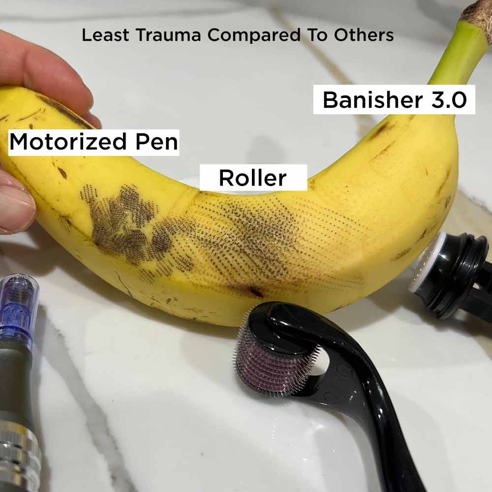 visual on banana showing the punctures created using a dr pen, banisher 3,0, and roller microneedling tool