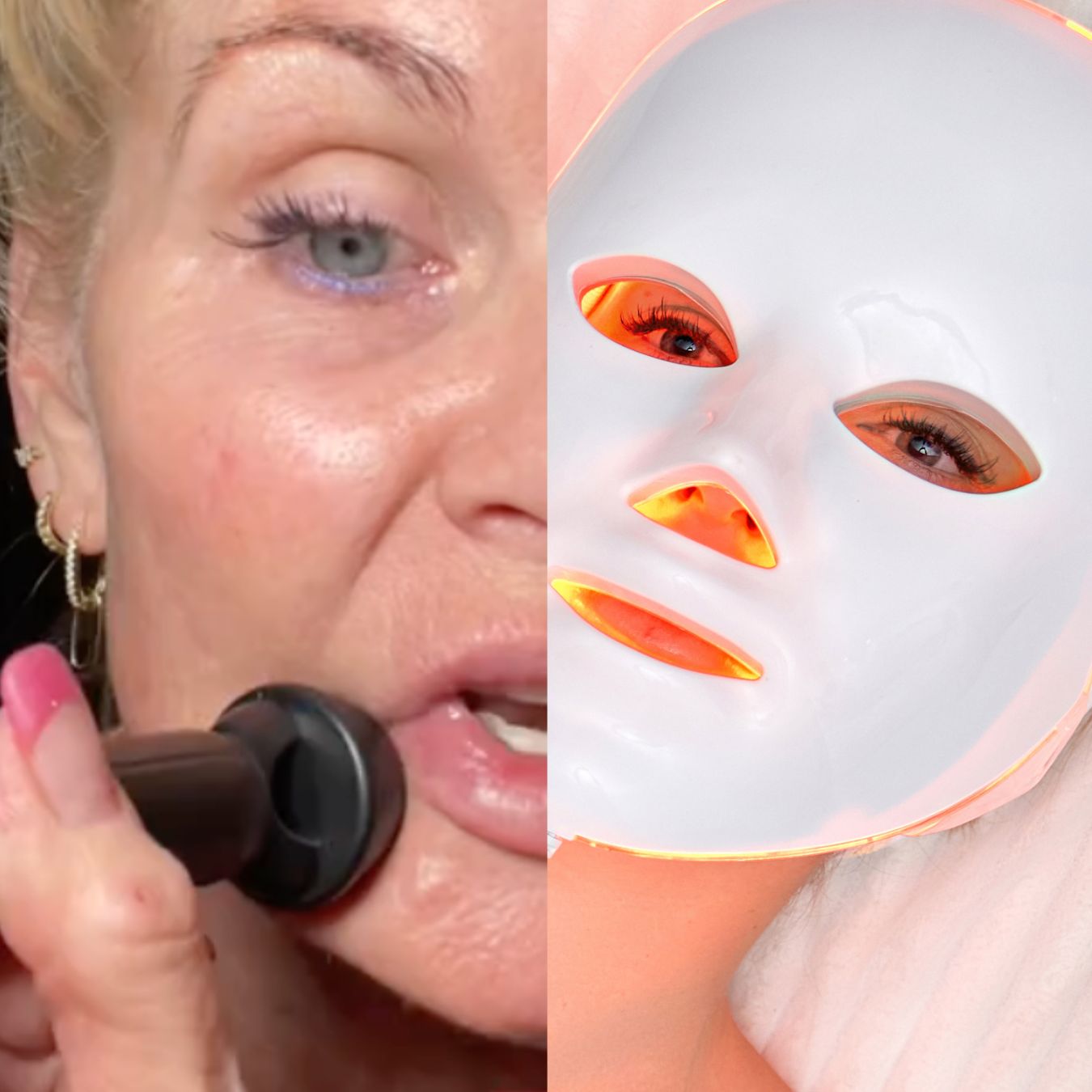led vs microneedling