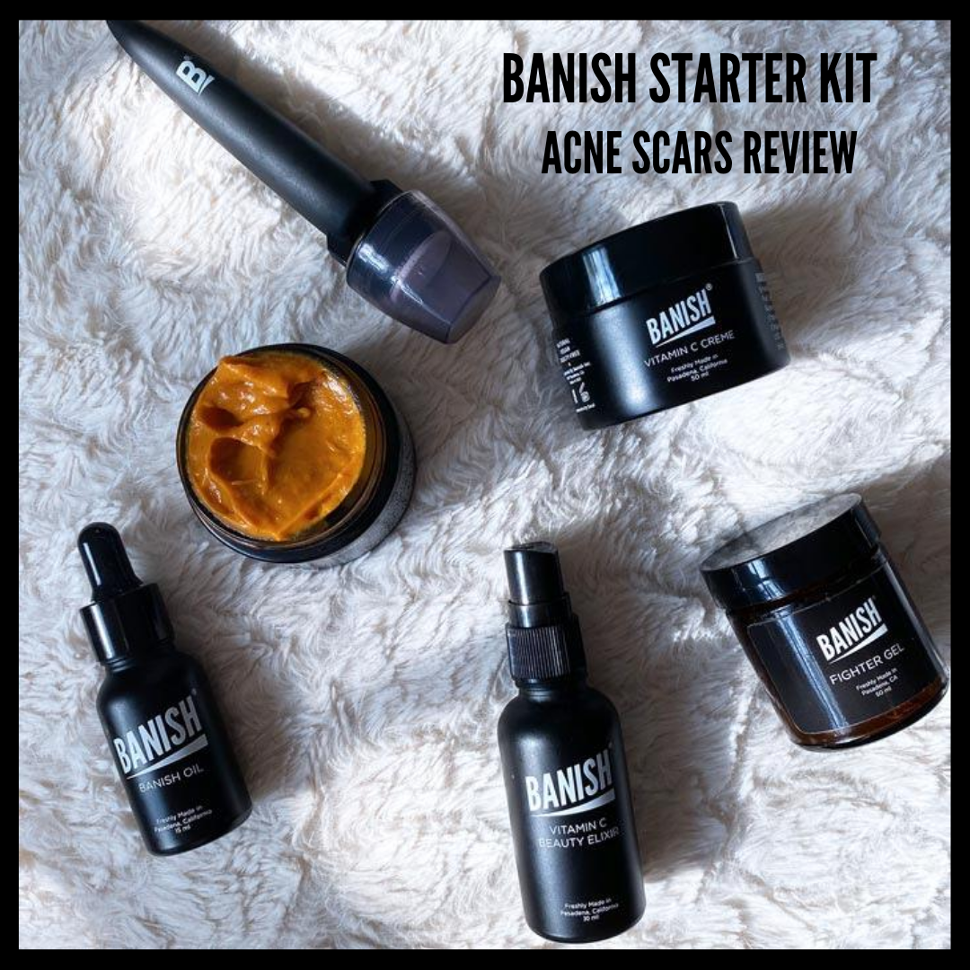 acne scars review
