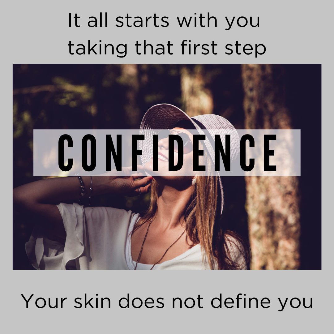 confidence with acne