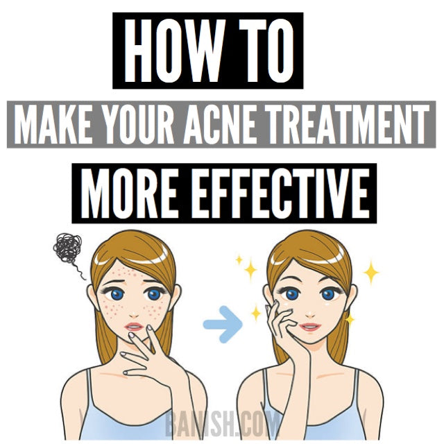 more effective acne treatment