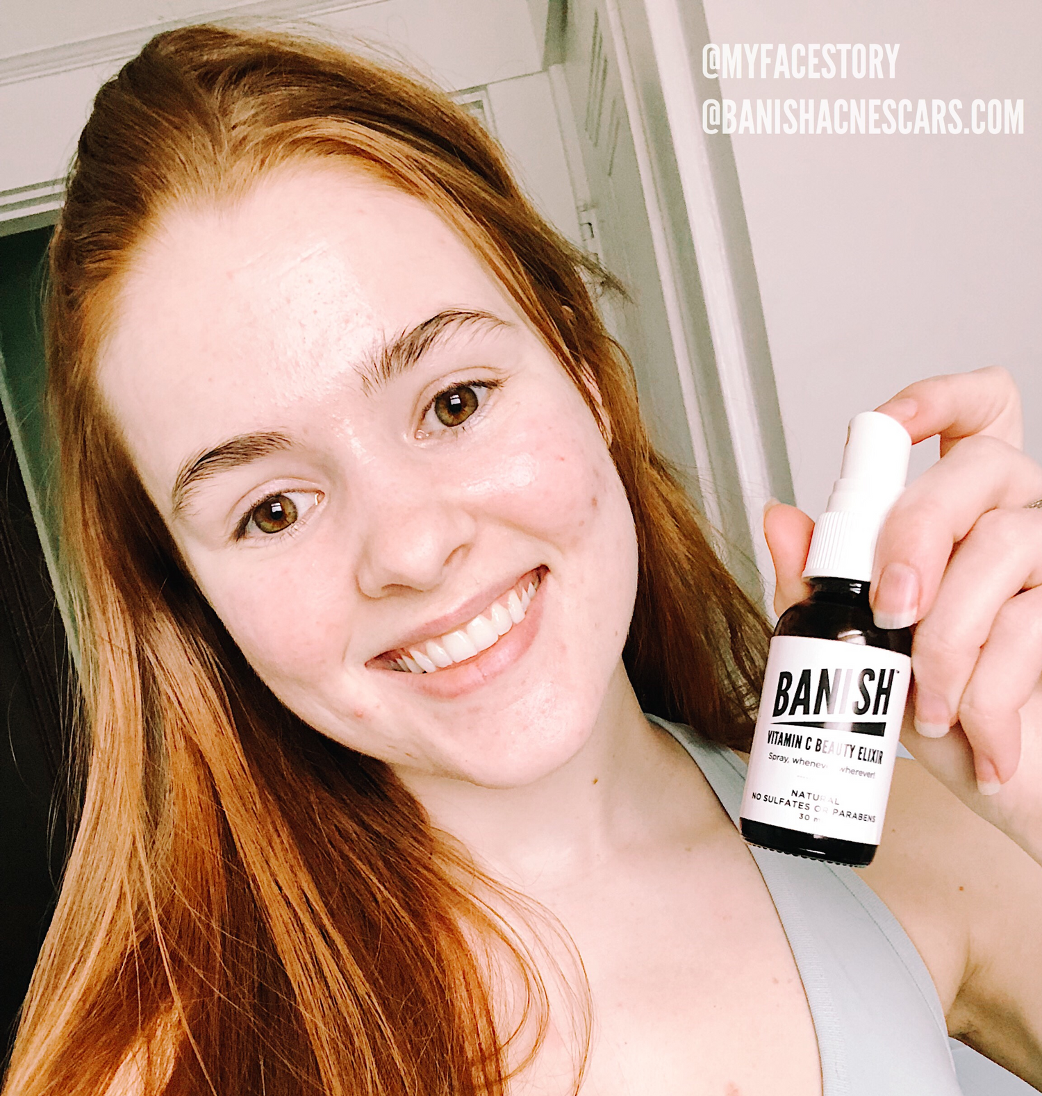 how to take care of the skin before and after workout