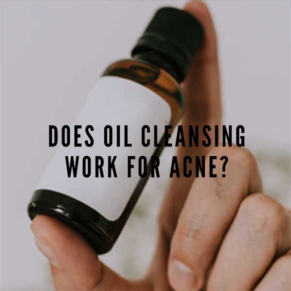 Oil cleansing store for acne