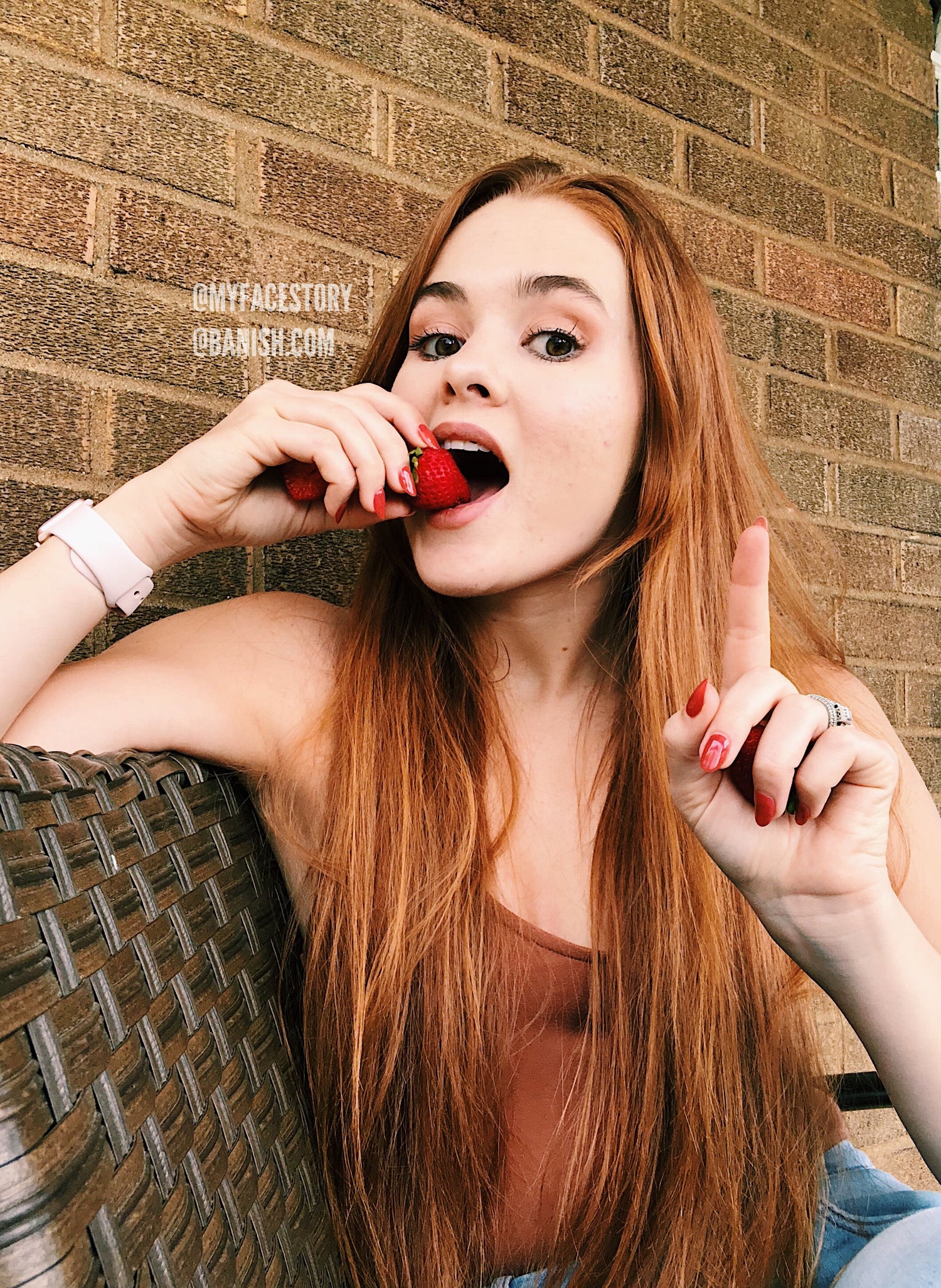 Food Intolerances and Acne: A Pinnertest Review