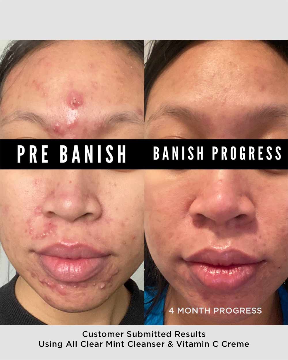 banish all clear mint cleanser results