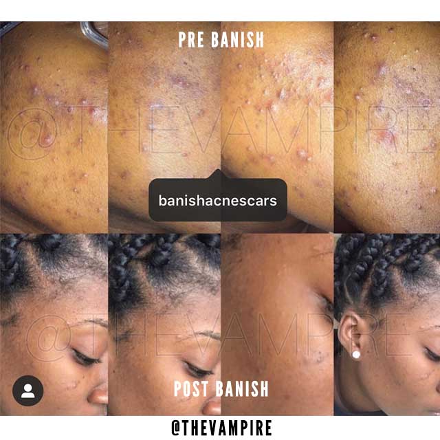 results with banish from thevampire