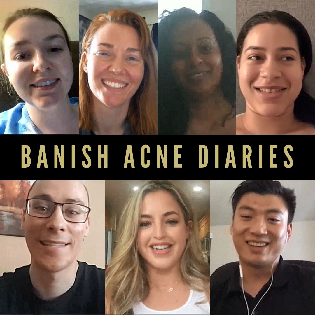 BANISH Acne Diaries: A Movement for Skin Positivity (Application)