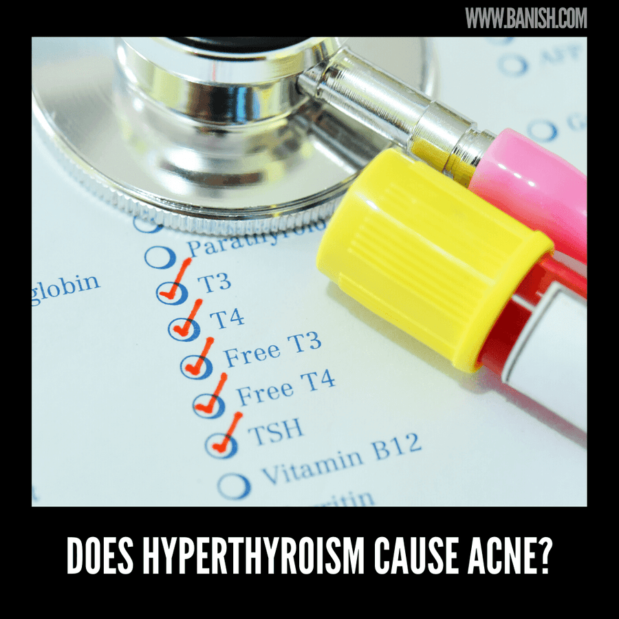 does-hyperthyroidism-cause-acne