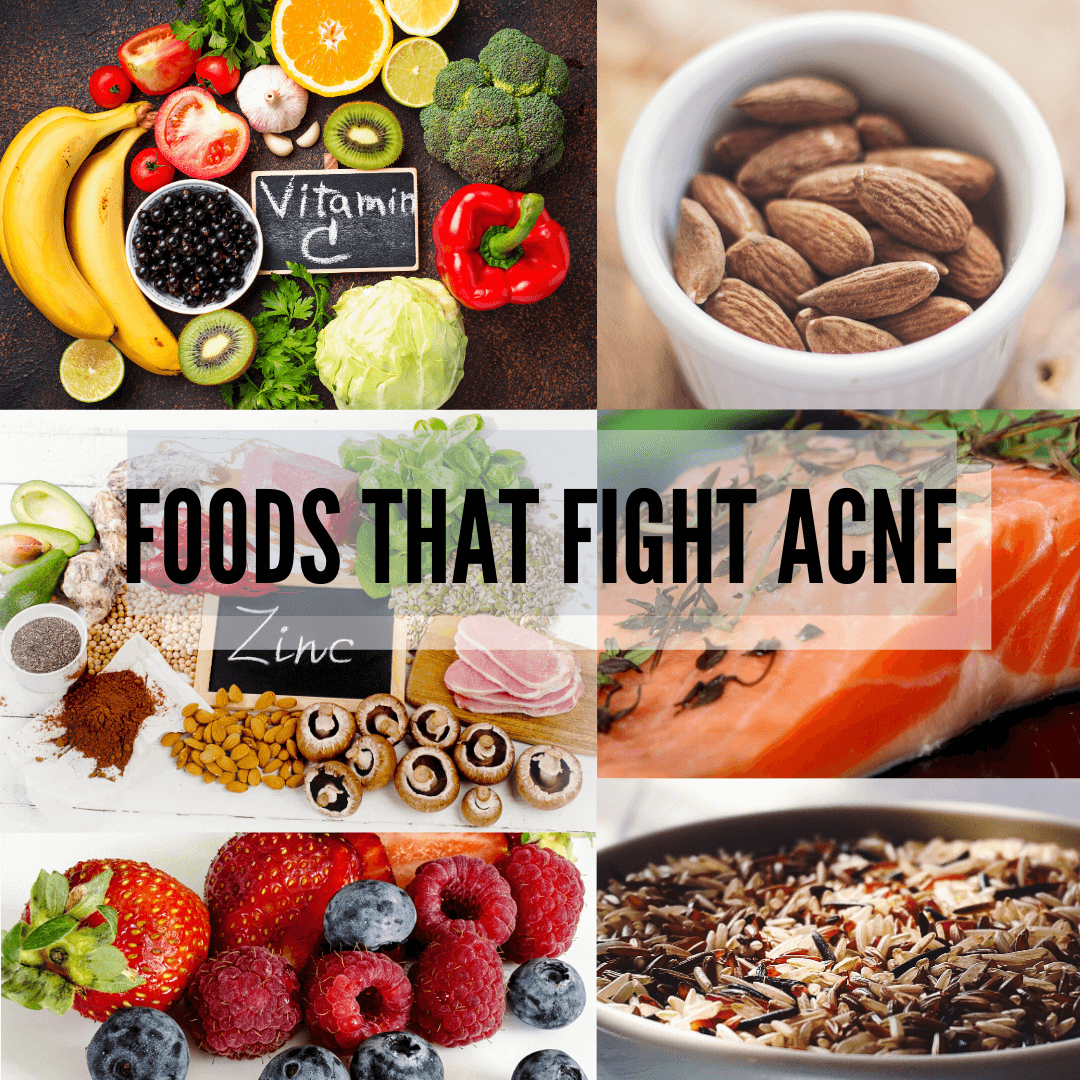 foods that fight acne
