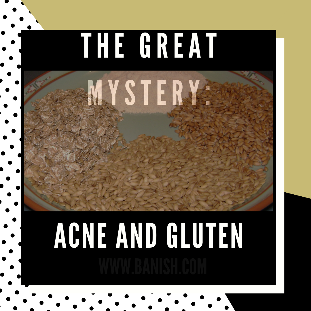 The Great Mystery: Acne and Gluten