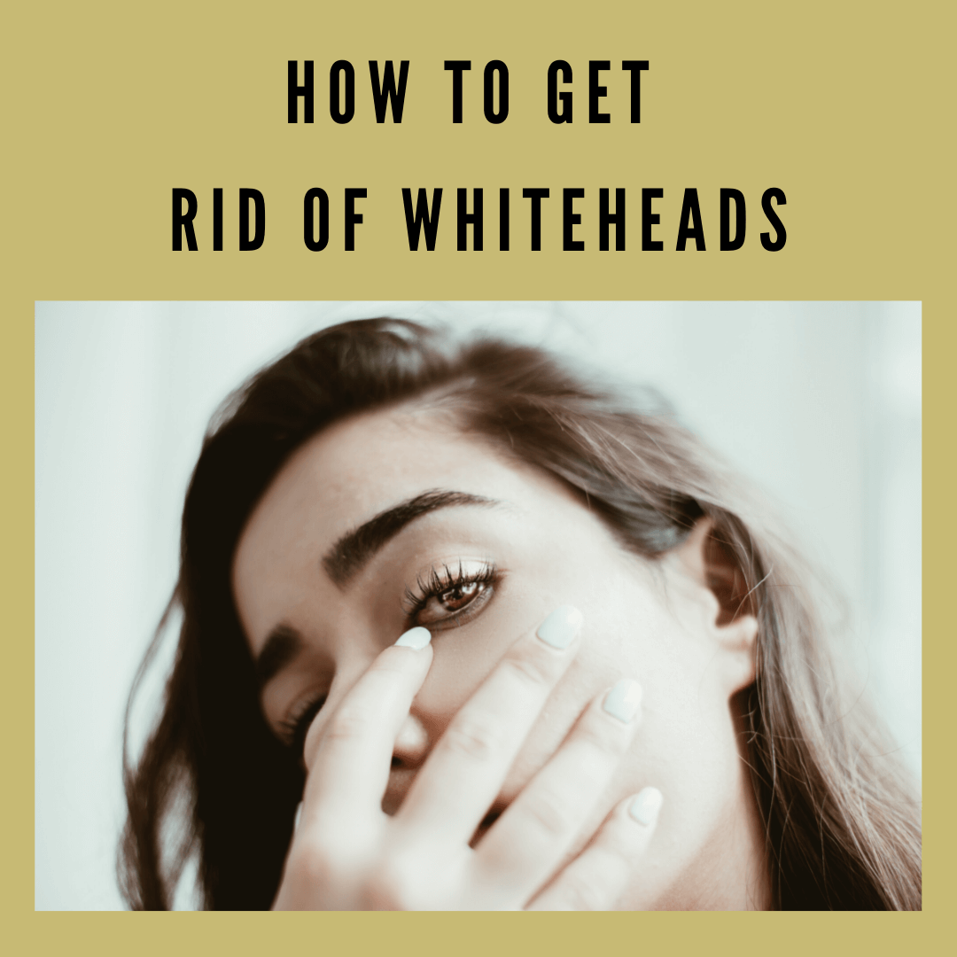 how to get rid of whiteheads