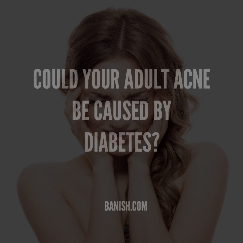 How Adult Acne and Diabetes Are Connected