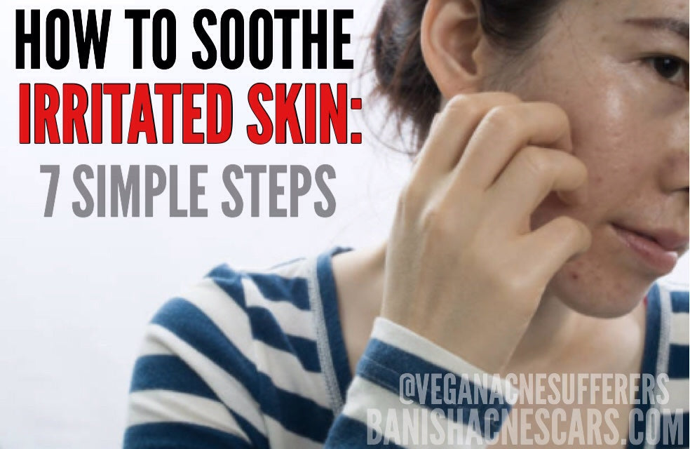 How to Soothe Irritated Skin: 7 Simple Steps