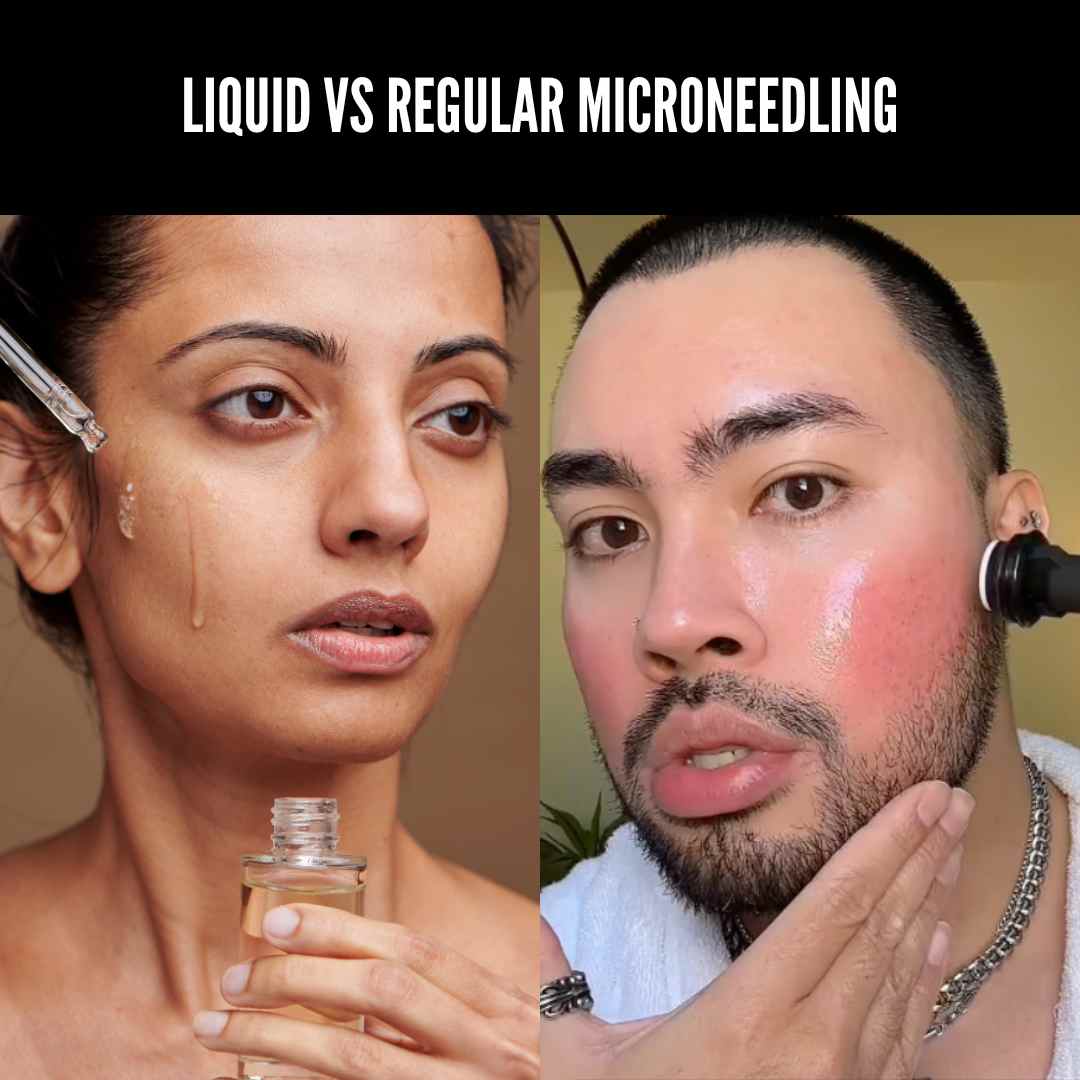 Microneedling Serums Compared to Regular Microneedling - What's The Difference