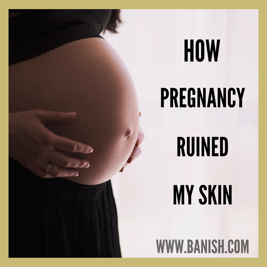 How Pregnancy Ruined My Skin