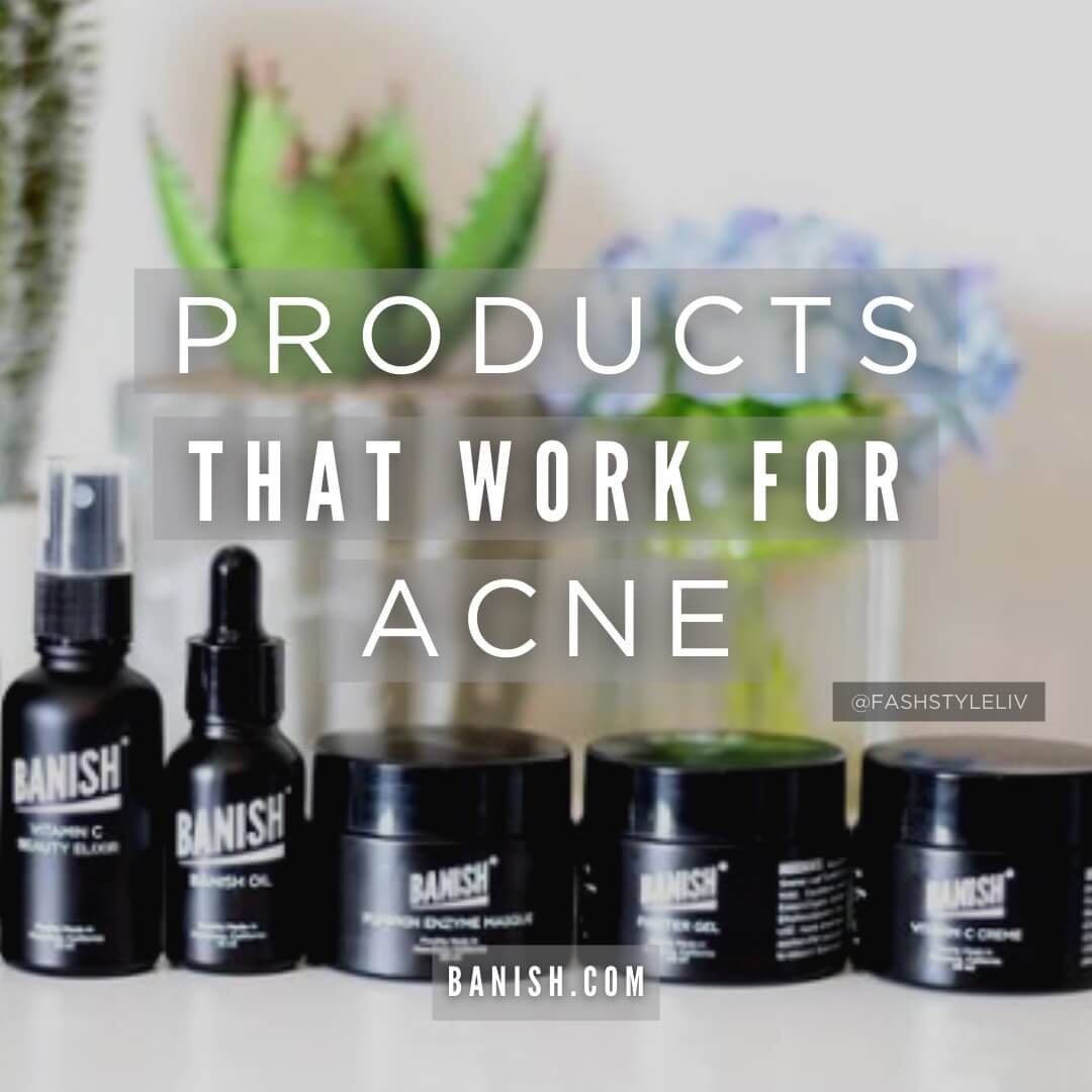 skincare products that work for acne