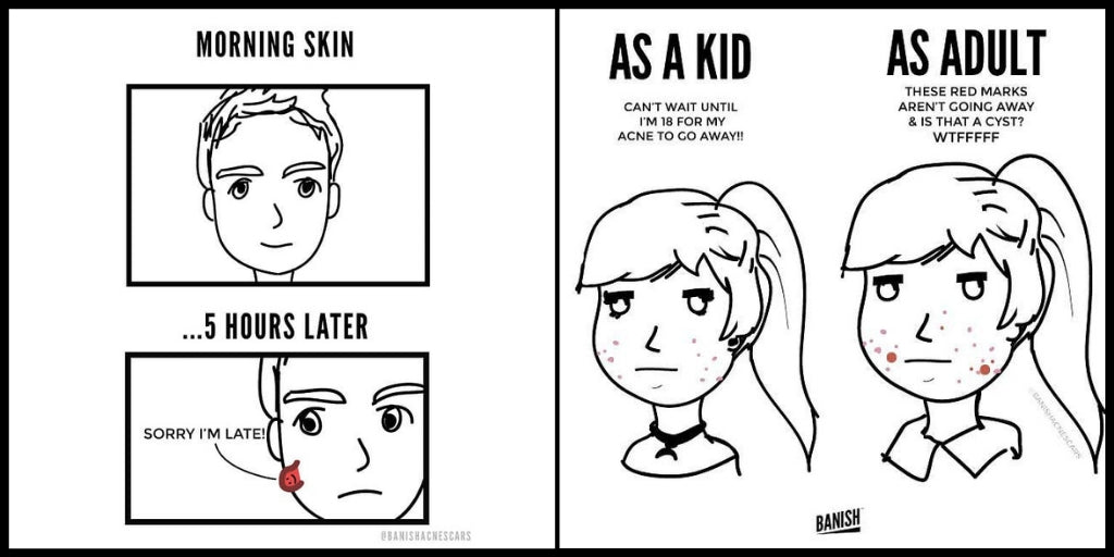 19 Comics that Only People with Acne will Understand
