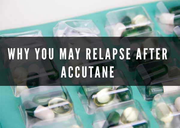 why you may relapse after accutane