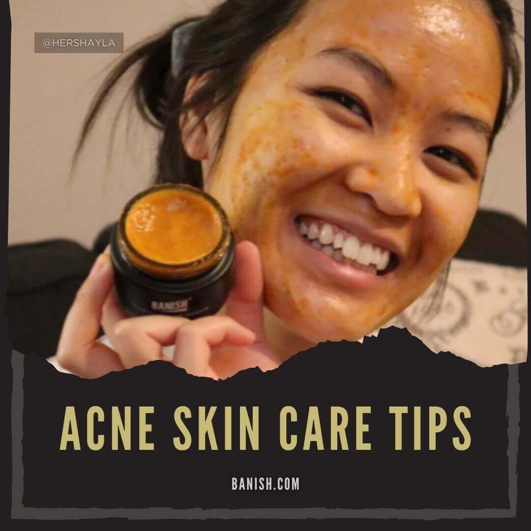 acne tips that work