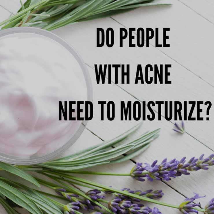 do people with acne need to moisturize