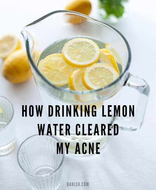 Drinking Lemon Water And Acne