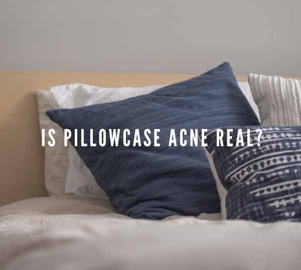 can pillowcase cause acne