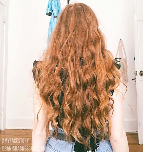 haircare is making me breakout 