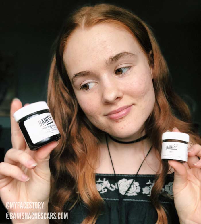 women holding skincare products