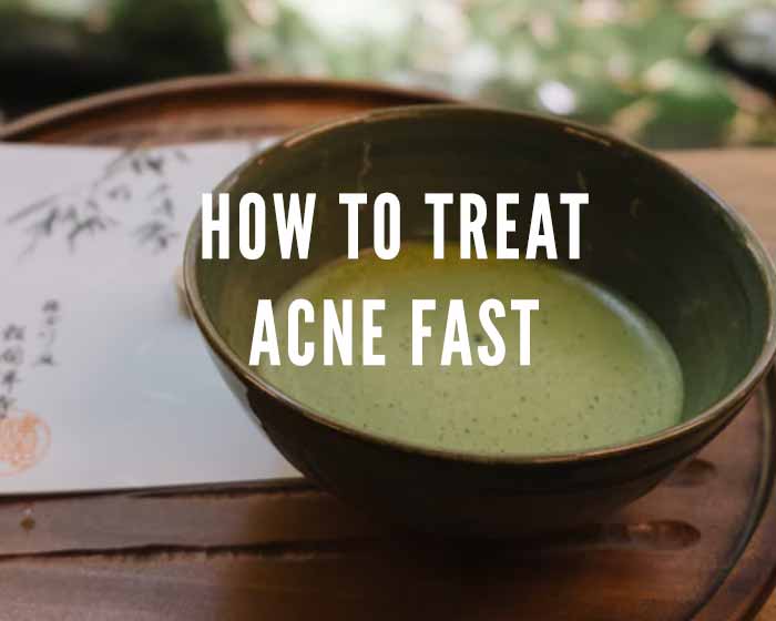 how to treat acne fast green tea