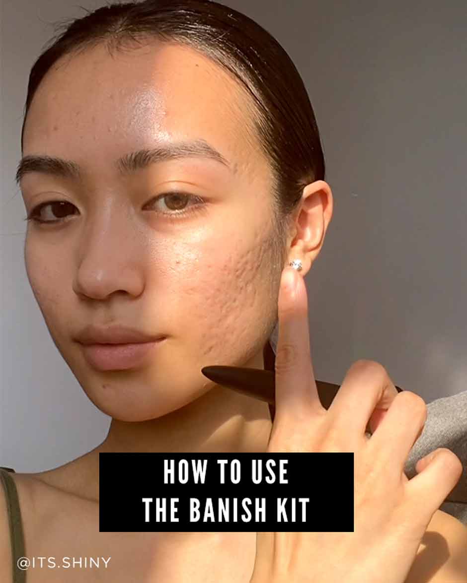 how to use the banish kit itsshiny