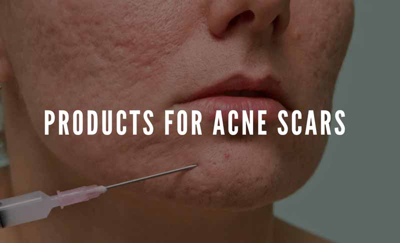 Treating Acne Scars