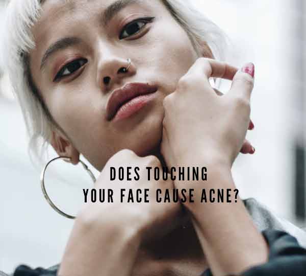 Does Touching Your Face Cause Acne?