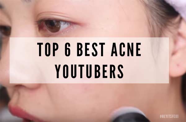 Best Acne YouTubers