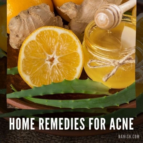easy home remedies for acne