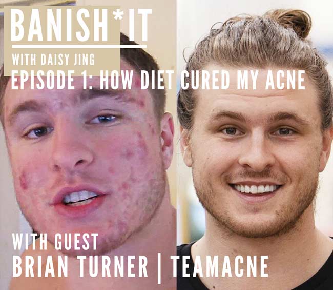 banish it podcast with guest brian turner