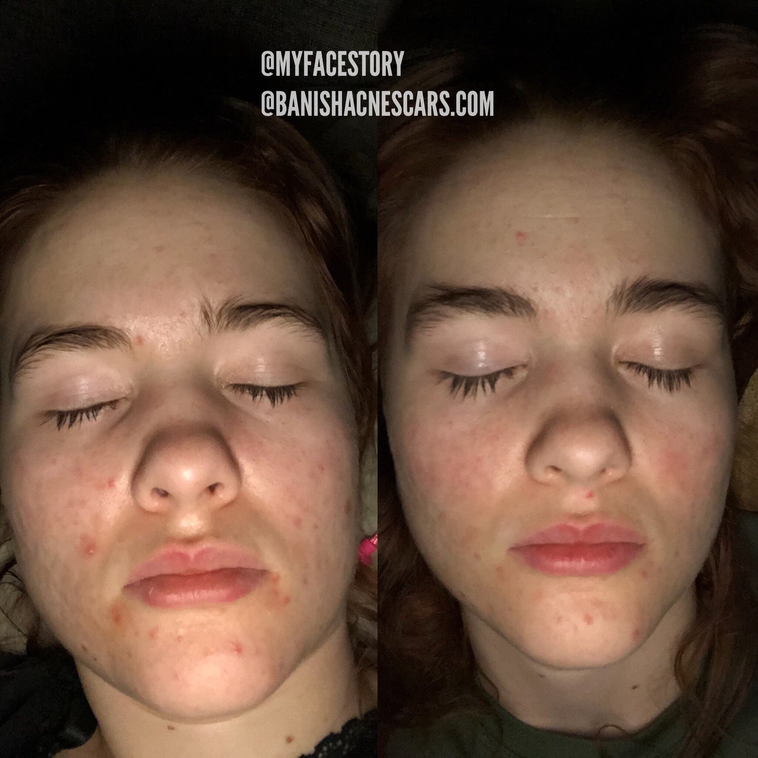 I Tried the Caveman Regimen for 1 Week and Here's What Happened