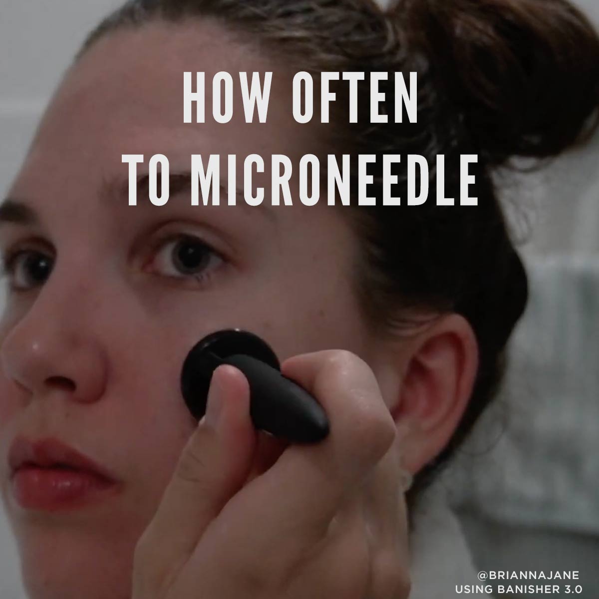 how often to microneedle