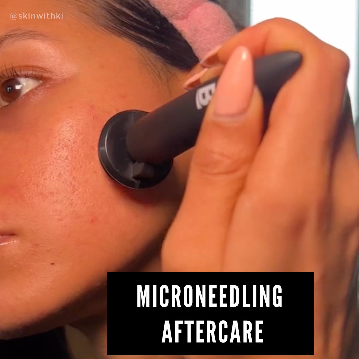 women microneedling with the Banisher