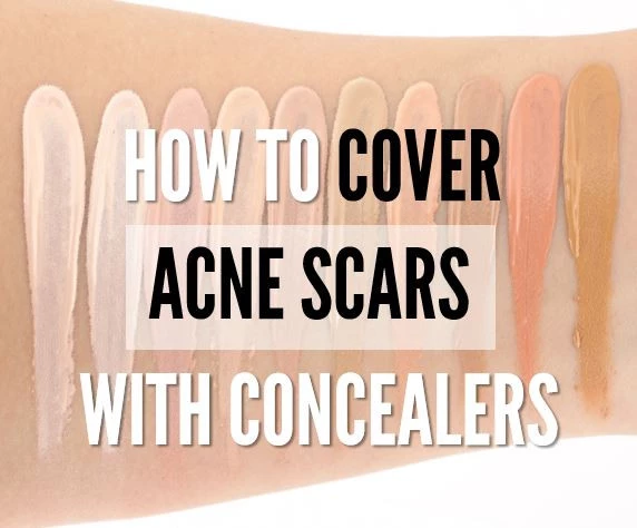 How To Cover Up Acne Scars With Makeup