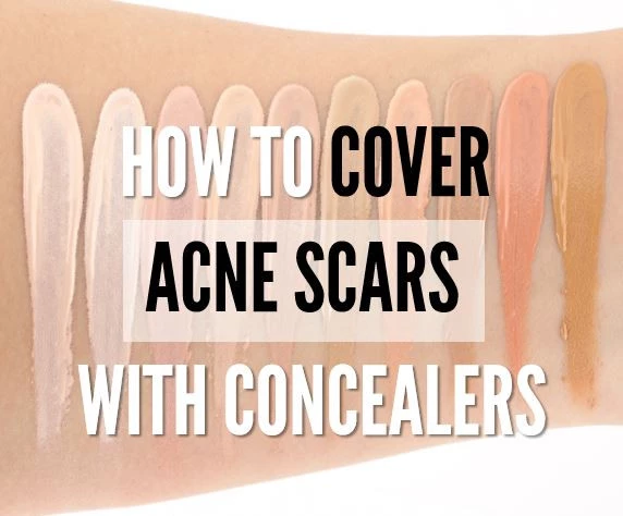 How to Cover Acne Scars with Makeup
