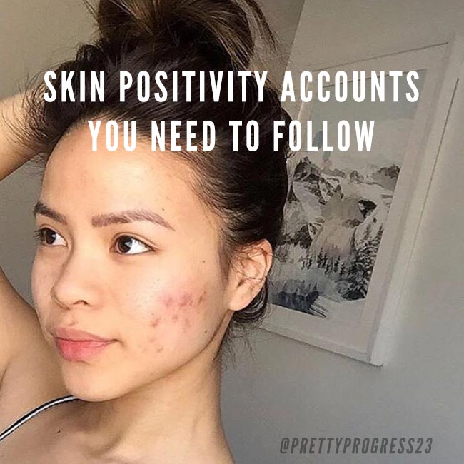 8 Skin Positivity Accounts you Should be Following