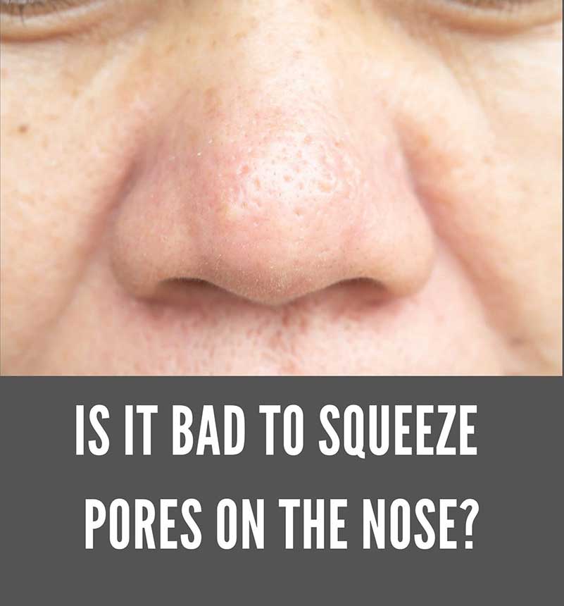 Is It Bad To Squeeze Pores On Nose