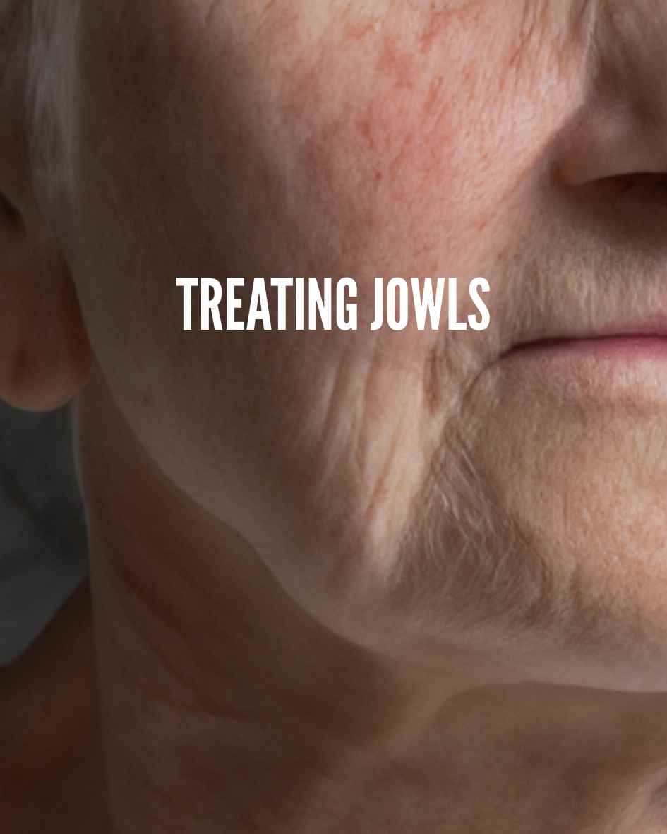 woman with jowls